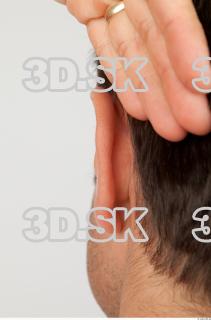 Ear texture of Koloman 0001